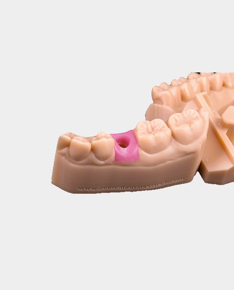 FotoDent gingiva 385 nm