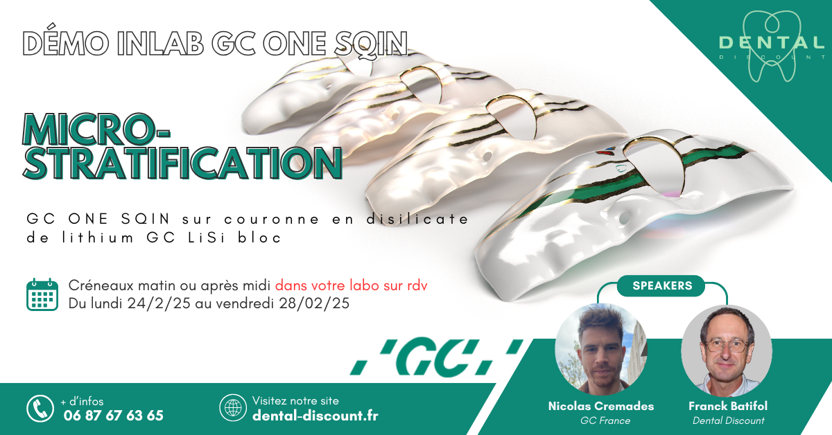 GC One Sqin sur couronne de disilicate de lithium GC Lisi Bloc